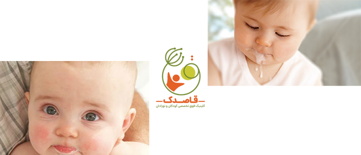 آشنایی با رفلاکس در نوزادان و کودکان